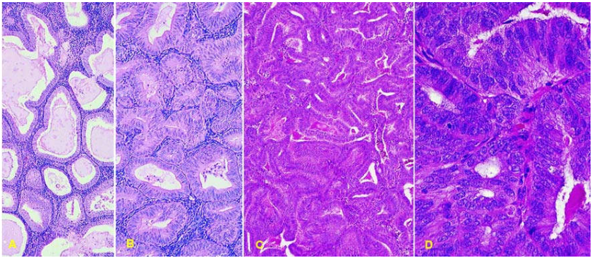 Giải phẫu bệnh